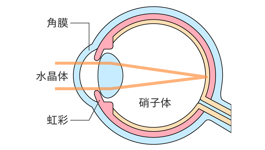 眼手術学 5 白内障 商品詳細ページ | メディカルブックセンター